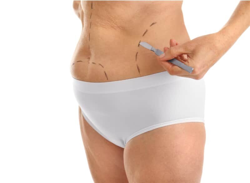 Tummy Tuck vs Lipo 360: Which Is Right for Me?