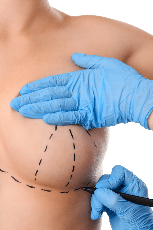 How Much Does a Breast Lift Cost?