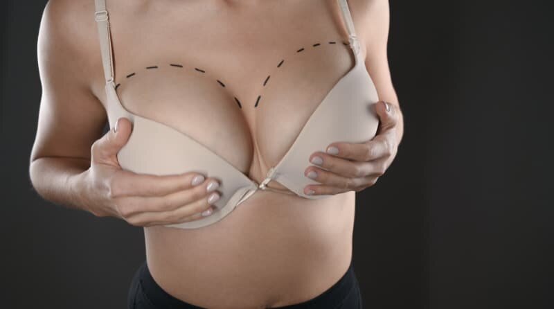 1 Cup Size in Just 10 Months with No Surgery: Breast
